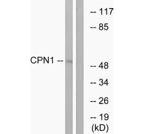 Western Blot - Anti-CPN1 Antibody (C14963) - Antibodies.com