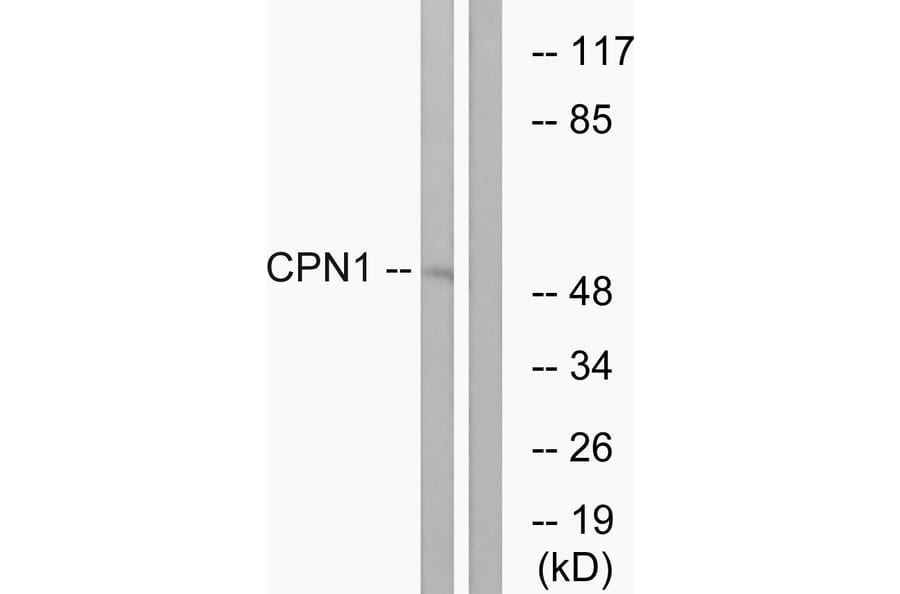 Western Blot - Anti-CPN1 Antibody (C14963) - Antibodies.com