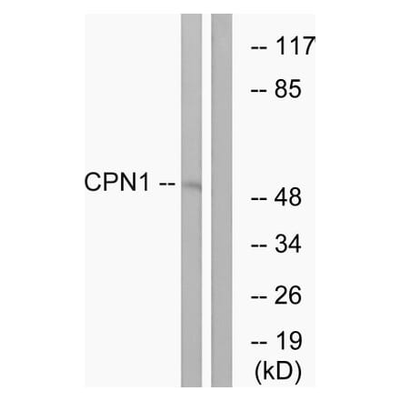 Western Blot - Anti-CPN1 Antibody (C14963) - Antibodies.com