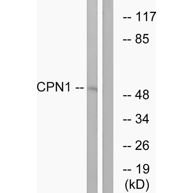 Western Blot - Anti-CPN1 Antibody (C14963) - Antibodies.com