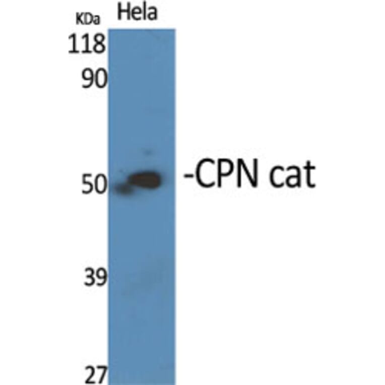 Western Blot - Anti-CPN1 Antibody (C14963) - Antibodies.com