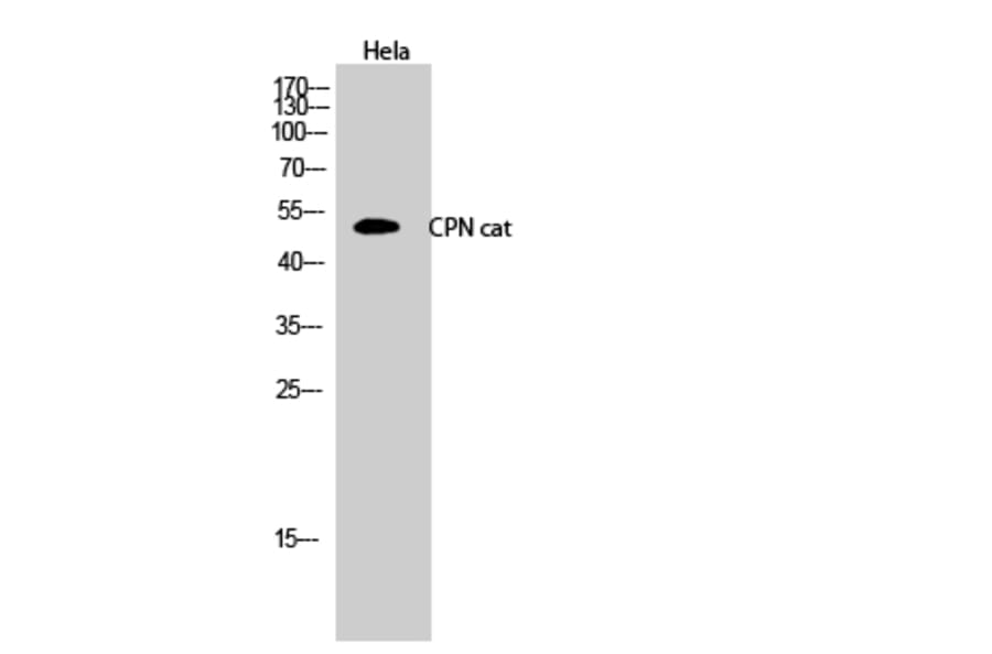 Western Blot - Anti-CPN1 Antibody (C14963) - Antibodies.com