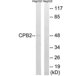 Western Blot - Anti-CPB2 Antibody (C14959) - Antibodies.com