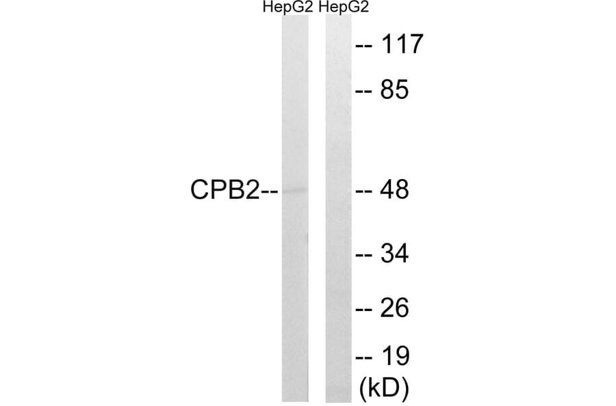 Western Blot - Anti-CPB2 Antibody (C14959) - Antibodies.com