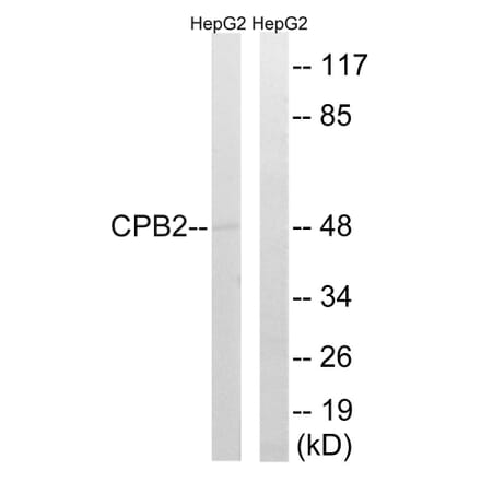 Western Blot - Anti-CPB2 Antibody (C14959) - Antibodies.com