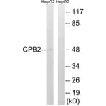 Western Blot - Anti-CPB2 Antibody (C14959) - Antibodies.com
