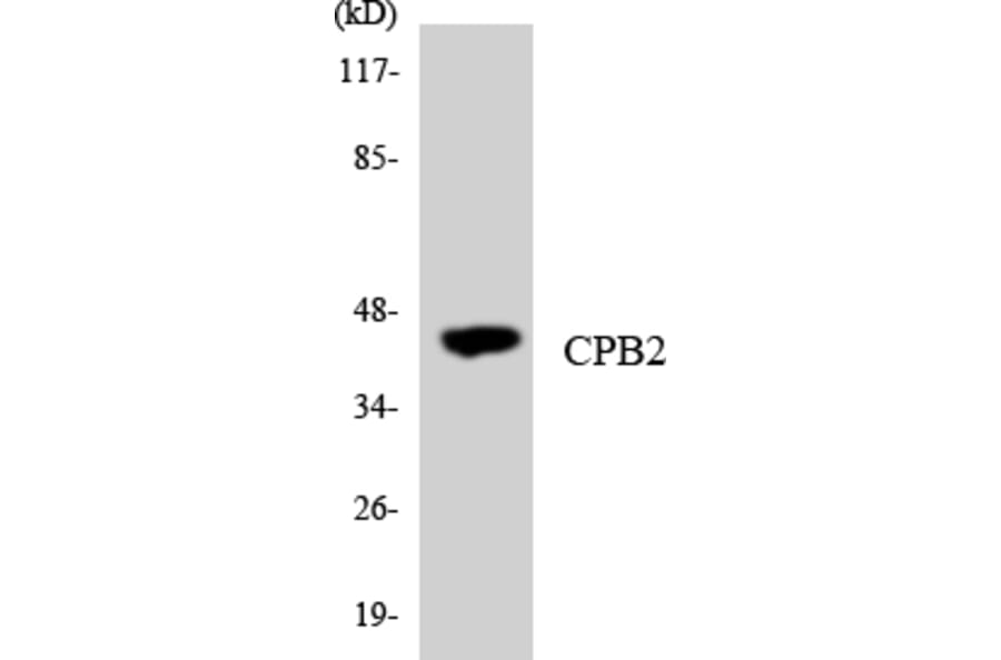 Western Blot - Anti-CPB2 Antibody (R12-2647) - Antibodies.com