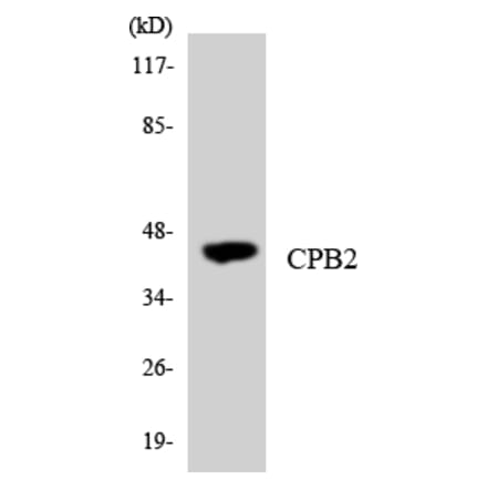 Western Blot - Anti-CPB2 Antibody (R12-2647) - Antibodies.com