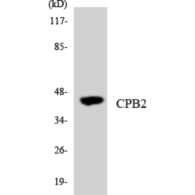 Western Blot - Anti-CPB2 Antibody (R12-2647) - Antibodies.com