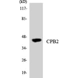 Western Blot - Anti-CPB2 Antibody (R12-2647) - Antibodies.com