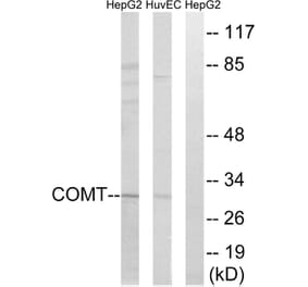 Western Blot - Anti-COMT Antibody (C14991) - Antibodies.com