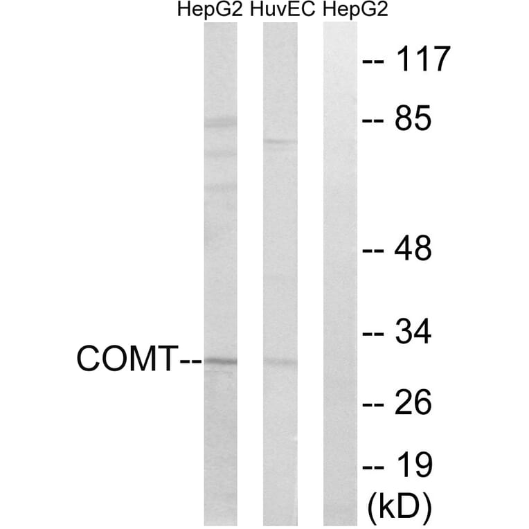 Western Blot - Anti-COMT Antibody (C14991) - Antibodies.com