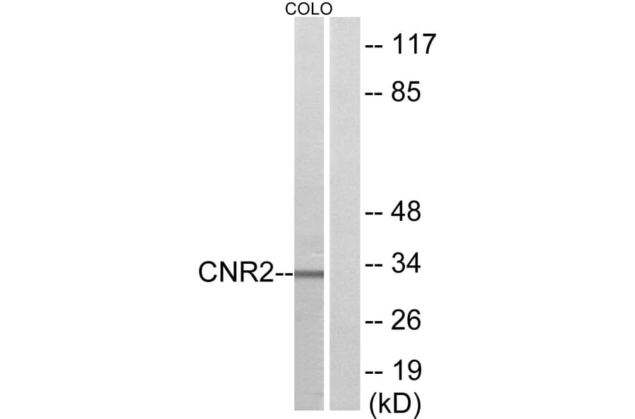 Western Blot - Anti-CNR2 Antibody (G227) - Antibodies.com