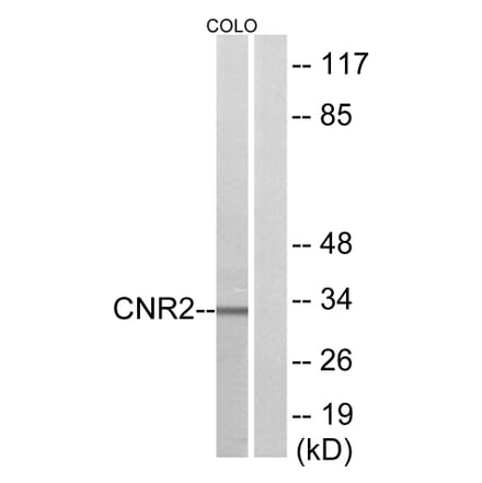 Western Blot - Anti-CNR2 Antibody (G227) - Antibodies.com