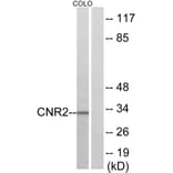 Western Blot - Anti-CNR2 Antibody (G227) - Antibodies.com