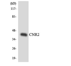 Western Blot - Anti-CNR2 Antibody (R12-2636) - Antibodies.com
