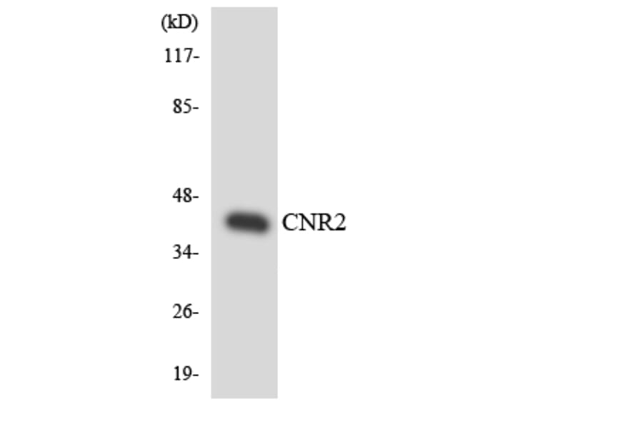 Western Blot - Anti-CNR2 Antibody (R12-2636) - Antibodies.com