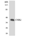 Western Blot - Anti-CNR2 Antibody (R12-2636) - Antibodies.com