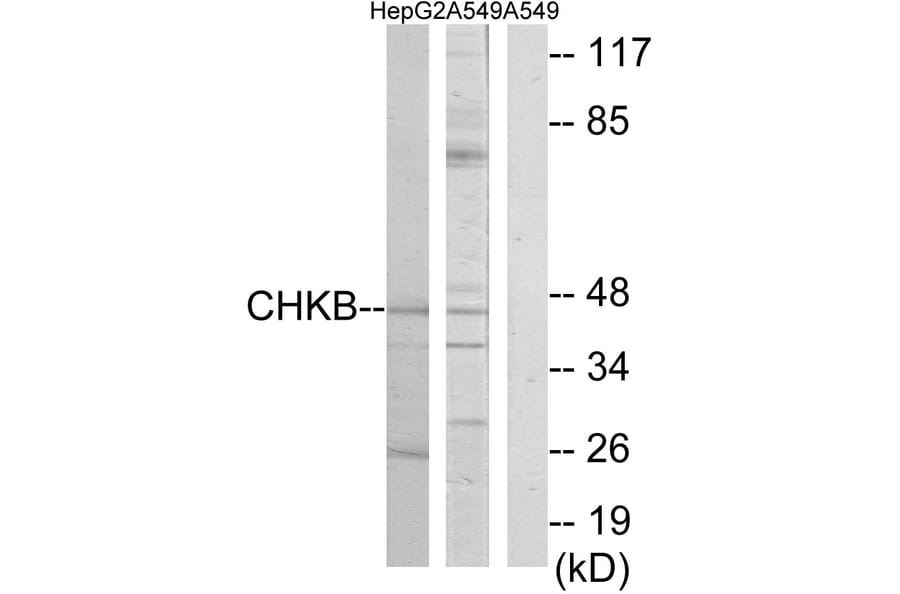 Western Blot - Anti-CHKB Antibody (C11923) - Antibodies.com
