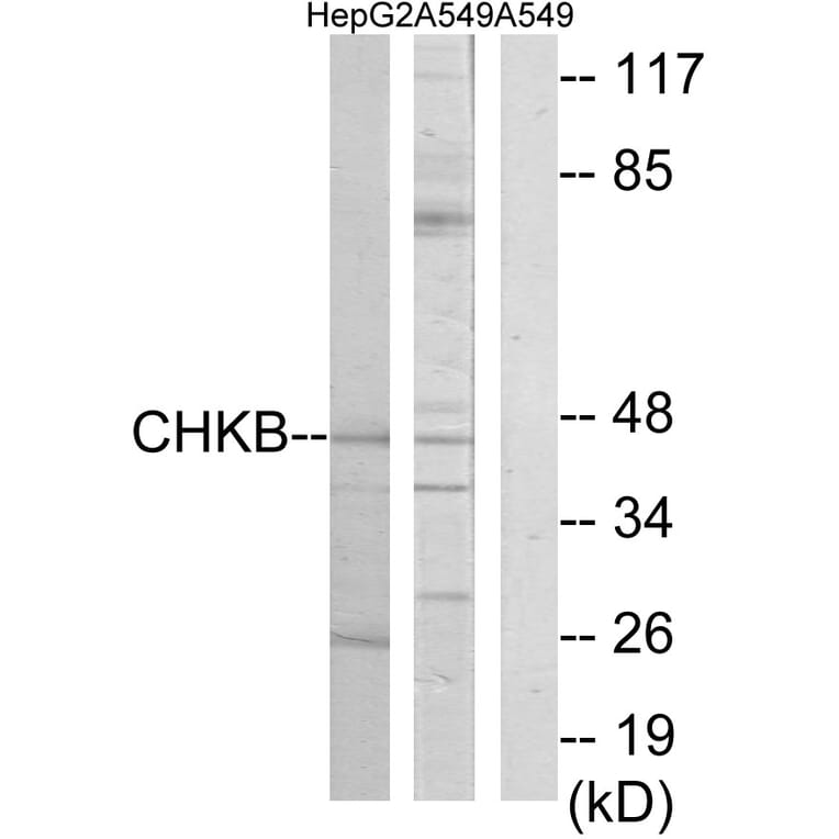 Western Blot - Anti-CHKB Antibody (C11923) - Antibodies.com