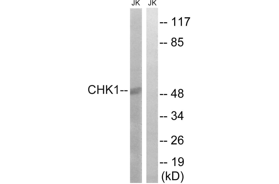 Western Blot - Anti-Chk1 Antibody (B7040) - Antibodies.com