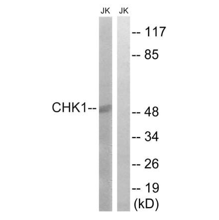 Western Blot - Anti-Chk1 Antibody (B7040) - Antibodies.com