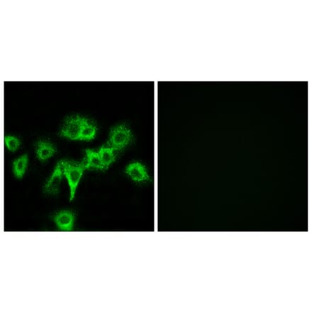 Immunofluorescence - Anti-CDON Antibody (C12181) - Antibodies.com