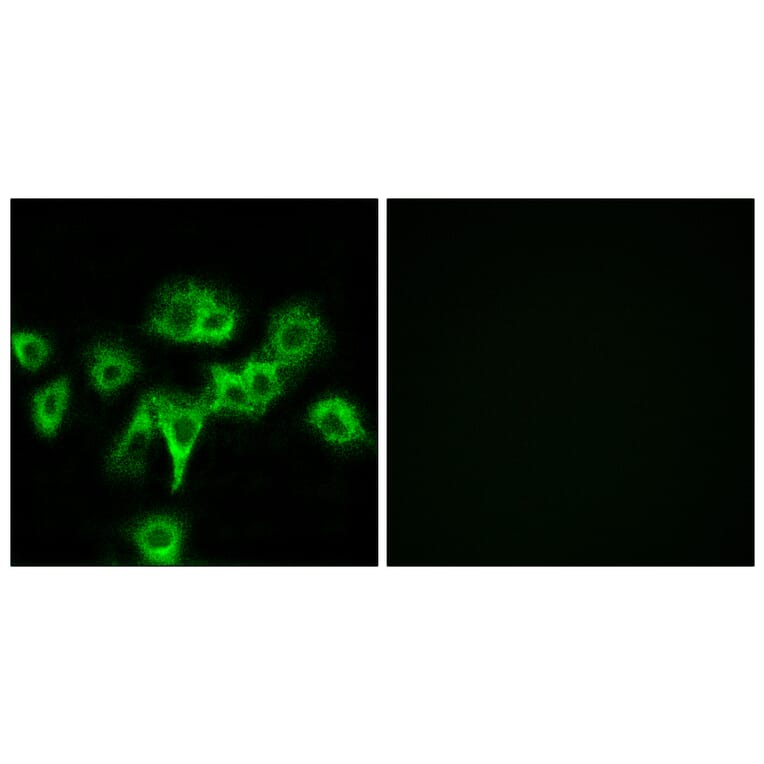 Immunofluorescence - Anti-CDON Antibody (C12181) - Antibodies.com