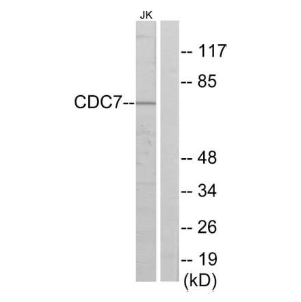 Western Blot - Anti-CDC7 Antibody (C10020) - Antibodies.com