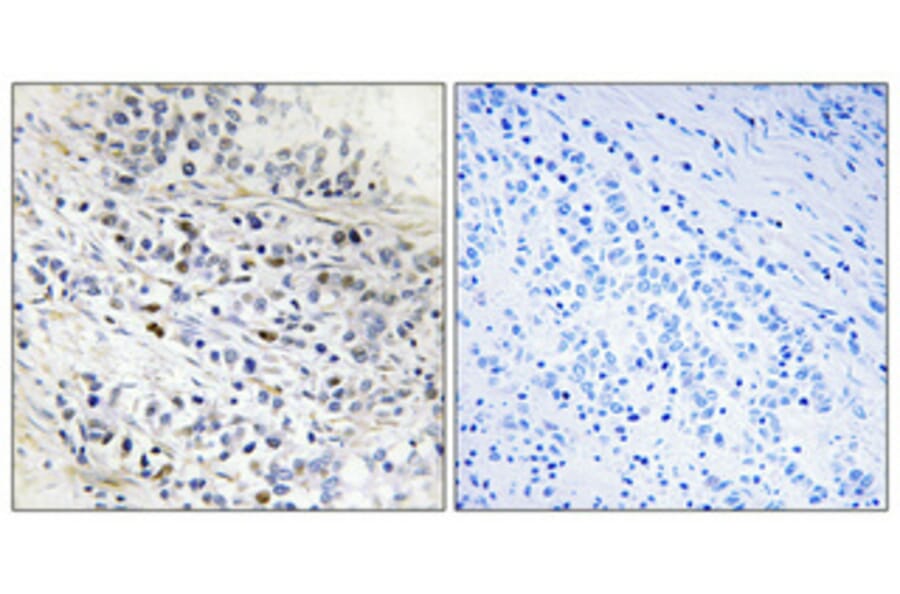 Immunohistochemistry - Anti-CDC7 Antibody (C10020) - Antibodies.com