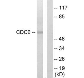 Western Blot - Anti-CDC6 Antibody (C12172) - Antibodies.com