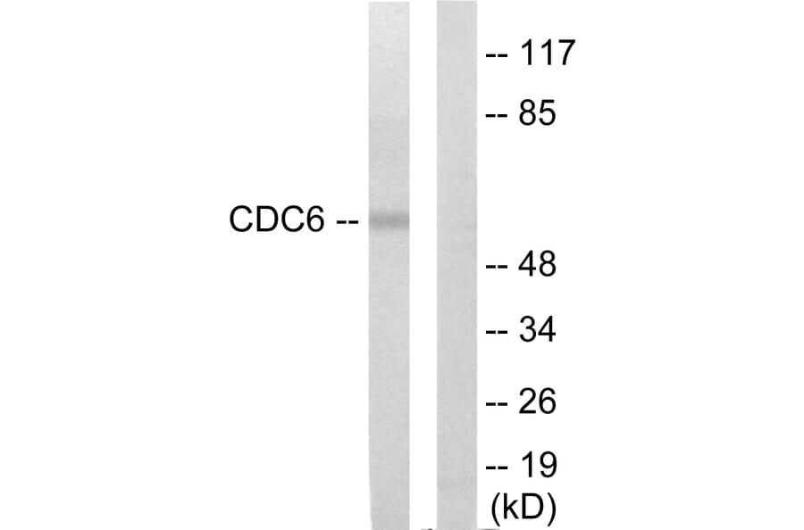 Western Blot - Anti-CDC6 Antibody (C12172) - Antibodies.com