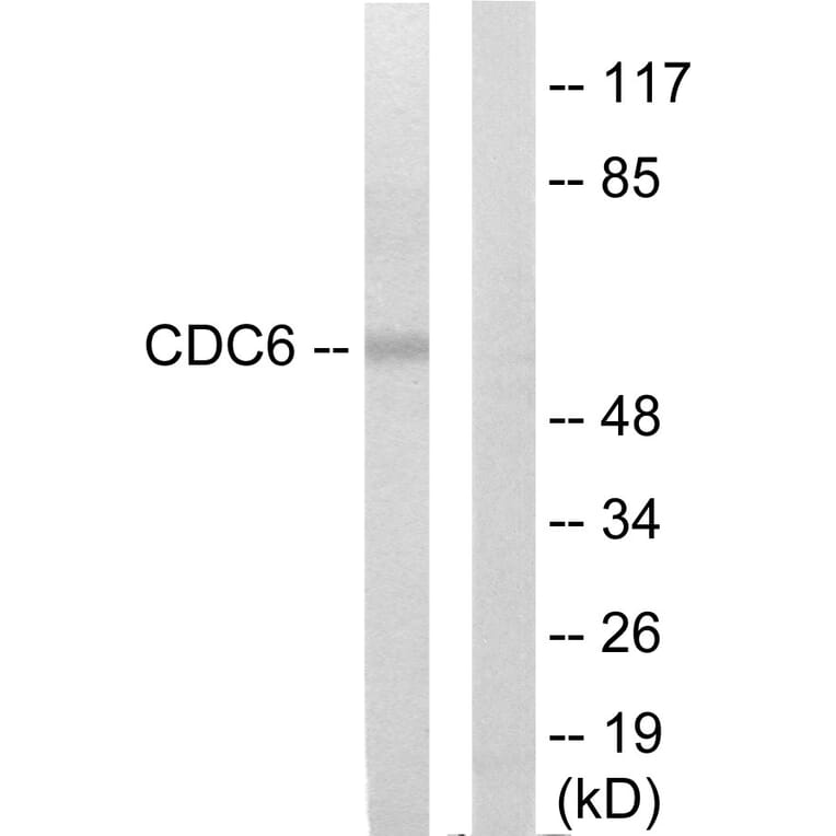 Western Blot - Anti-CDC6 Antibody (C12172) - Antibodies.com