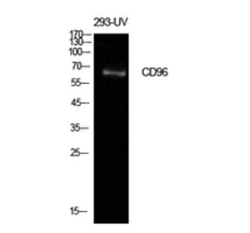 Western Blot - Anti-CD96 Antibody (C30401) - Antibodies.com