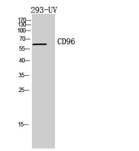 Western blot analysis of 293 UV cells using Anti-CD96 Antibody.