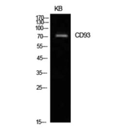 Western Blot - Anti-CD93 Antibody (C30398) - Antibodies.com