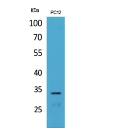 Western Blot - Anti-CD74 Antibody (C30383) - Antibodies.com