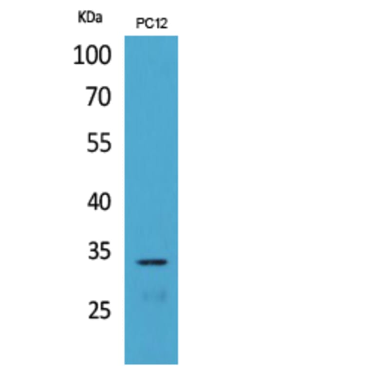 Western Blot - Anti-CD74 Antibody (C30383) - Antibodies.com