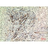 Immunohistochemistry - Anti-CD74 Antibody (C30383) - Antibodies.com