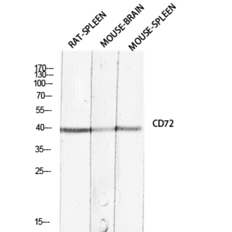 Western Blot - Anti-CD72 Antibody (C30381) - Antibodies.com