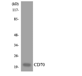 Western Blot - Anti-CD70 Antibody (R12-2592) - Antibodies.com