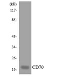 Western Blot - Anti-CD70 Antibody (R12-2592) - Antibodies.com