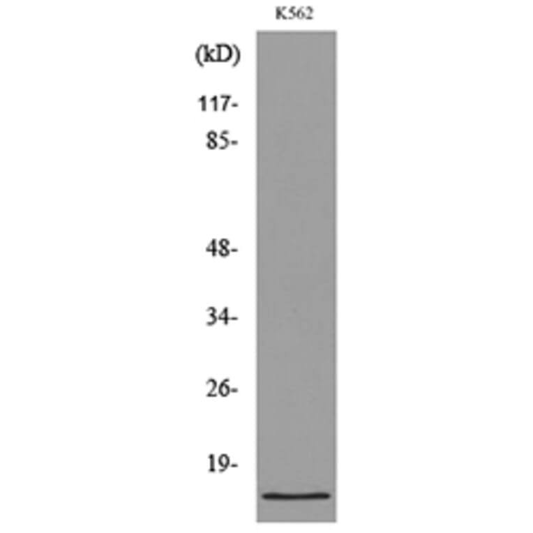 Western Blot - Anti-CD59 Antibody (C30369) - Antibodies.com