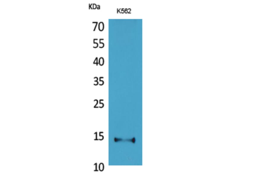 Western Blot - Anti-CD59 Antibody (C30369) - Antibodies.com
