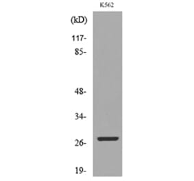 Western Blot - Anti-CD58 Antibody (C30368) - Antibodies.com