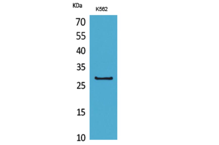 Western Blot - Anti-CD58 Antibody (C30368) - Antibodies.com