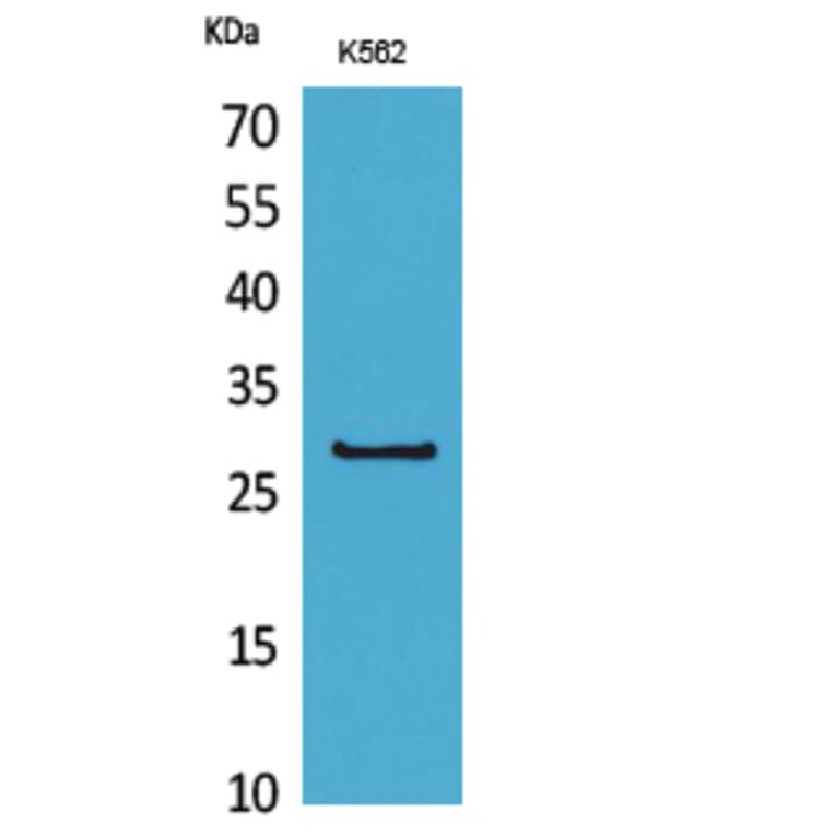 Western Blot - Anti-CD58 Antibody (C30368) - Antibodies.com