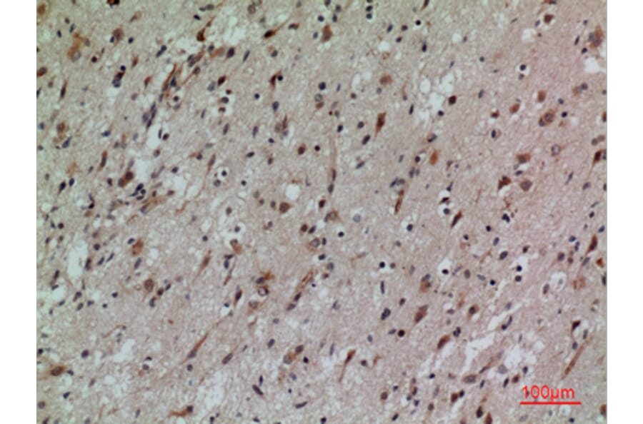 Immunohistochemistry - Anti-CD58 Antibody (C30368) - Antibodies.com