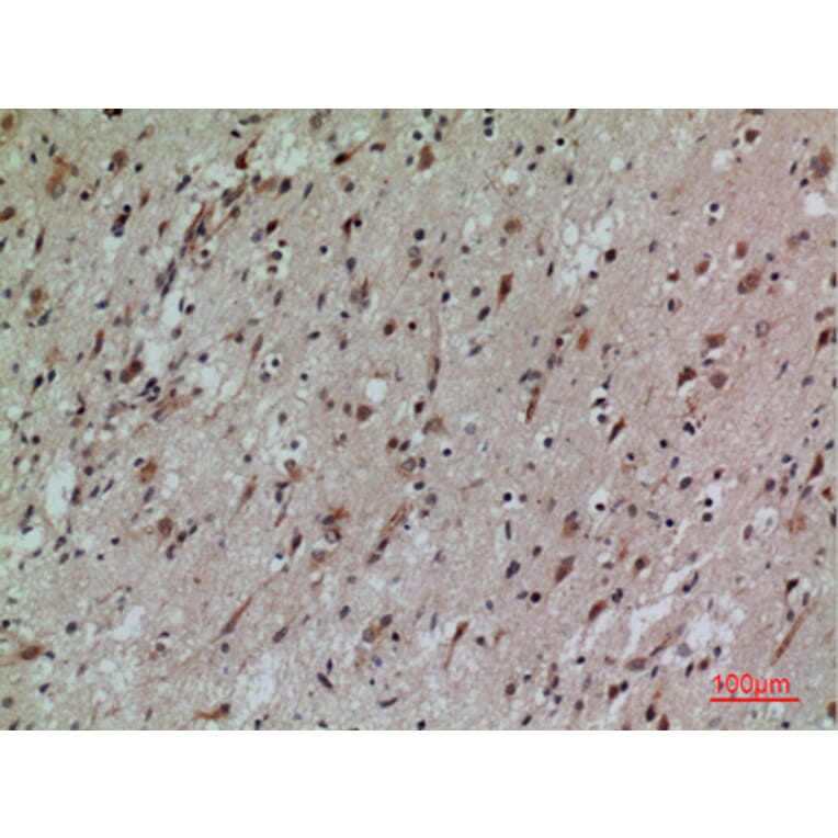 Immunohistochemistry - Anti-CD58 Antibody (C30368) - Antibodies.com