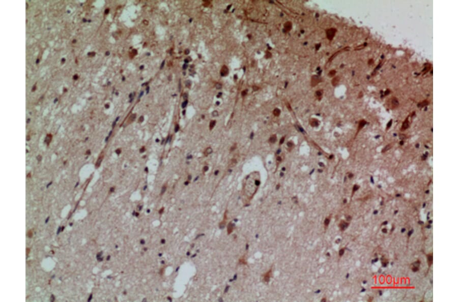 Immunohistochemistry - Anti-CD58 Antibody (C30368) - Antibodies.com